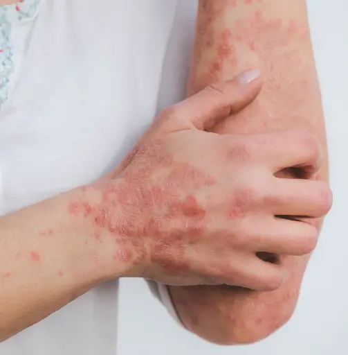 Dermatology and Chinese Herbal Therapy (Jan '27)