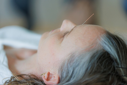 PG Acupunctuur 3e jaar